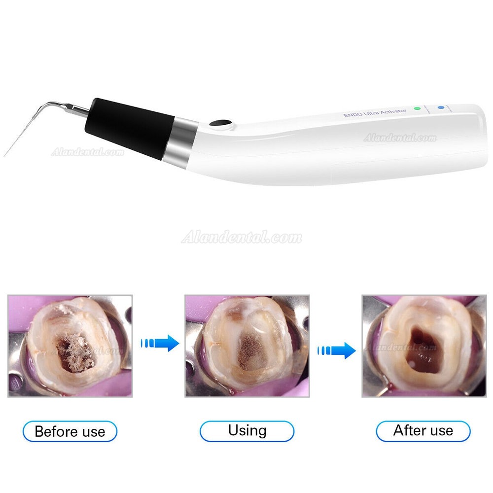 Cordless Ultrasonic Dental Endo Ultra Activator Handpiece 300° Irrigator Pen CE